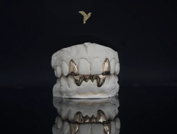 PrimeGrillz-Gold Grillz-RudeTeen-P1