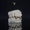 PrimeGrillz-Gold Grillz-RudeTeen-P2