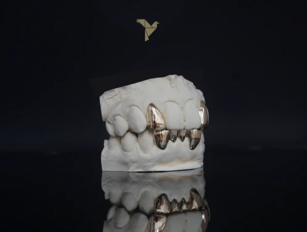 PrimeGrillz-Gold Grillz-RudeTeen-P2