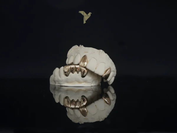 PrimeGrillz-Gold Grillz-RudeTeen-P3