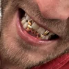 PrimeGrillz-Gold Grillz-RudeTeen-P4