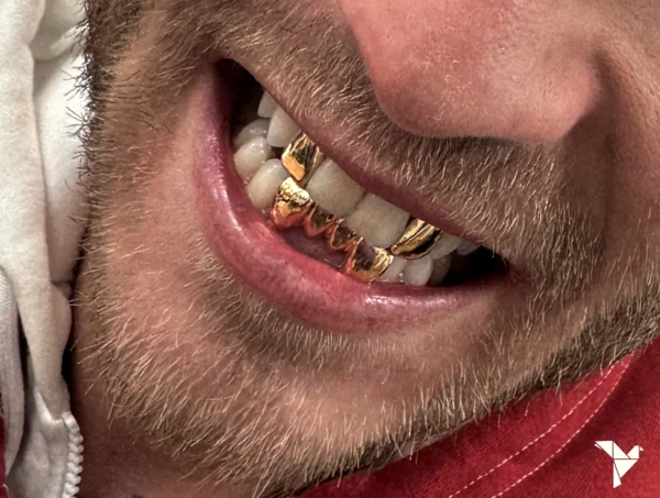 PrimeGrillz-Gold Grillz-RudeTeen-P4